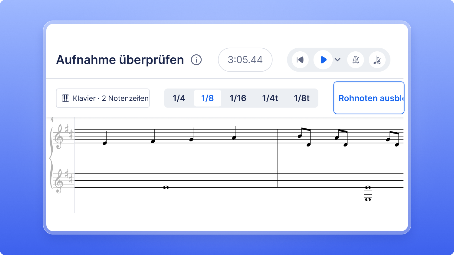 Schalter zum Aus- und Einblenden der Rohnoten